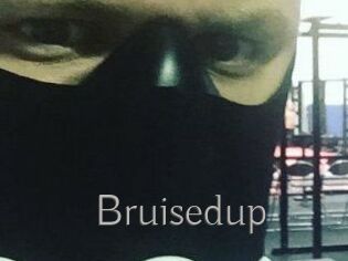 Bruisedup