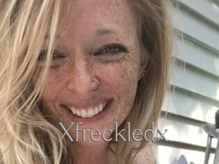 Xfreckledx